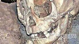 秘鲁惊现巨大的外星人婴儿头骨