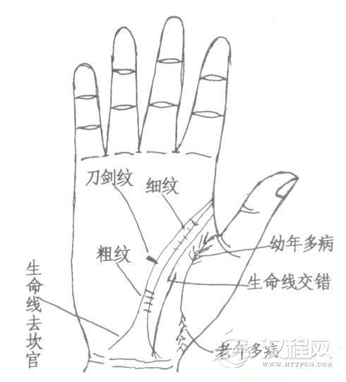 手相生命线断开、岛纹、三角纹,手上的生命线