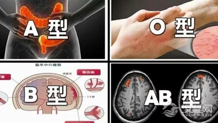 血型之中暗藏你的健康密码，看看你容易得什么病！