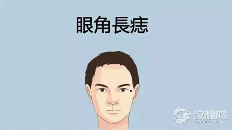 身体有这5颗痣，是做生意的好手！